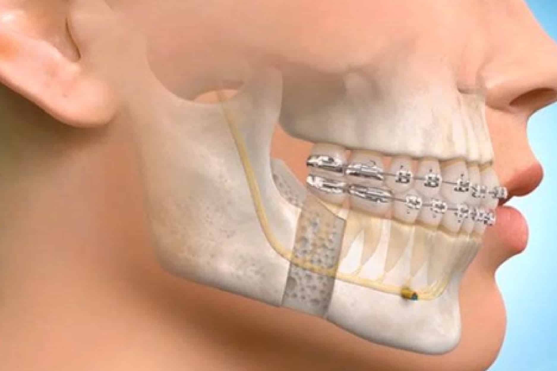 Best Oral And  Maxillofacial Surgeons in India